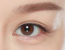做完双眼皮 我这张脸算是被拯救了