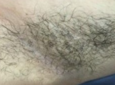 腋毛脱干净啦 裙子想怎么穿就怎么穿-41904
