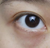 黑眼圈和眼袋哪个才是让你显老10岁 如何去除黑眼圈和眼袋