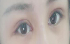 看脸的时代 没有一双好看的双眼皮怎么行呢-42782