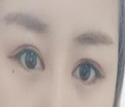 看脸的时代 没有一双好看的双眼皮怎么行呢-42783