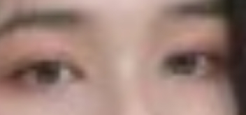 割双眼皮后再也不用提前半个小时贴双眼皮贴啦