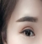 医生真的对双眼皮手术有研究 感谢自己选择了人