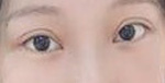 眼睛显得非常有神 双眼皮更是睁眼有型