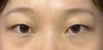 眼睛显得非常有神 双眼皮更是睁眼有型-43361