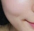 皮肤状态不是很好 朋友建议我去做光子嫩肤