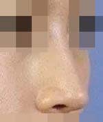 整个鼻子的形态都很棒 鼻梁高高的
