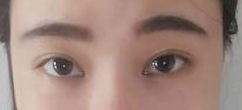 现在眼睛很自然 很有神