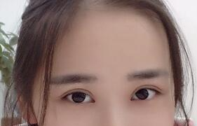 现在的眼睛很好看 我很满意-44422
