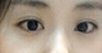我的咪咪眼终于有救了 变漂亮之后怎么拍怎么好看