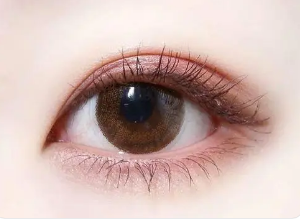 双眼皮自然与不自然有什么区别 如何割出自然双眼皮呢