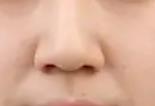 鼻子塌的女孩怎样逆袭 由丑变美