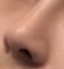 鼻子变好看了 颜值也提升了-45014
