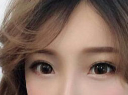 没有眼袋整个人看上去很有精神