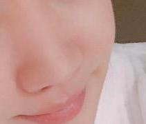 隆了鼻子 朋友都夸我好看-45261