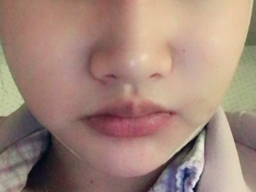 脸都小了不少现在-46130