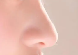 做鼻尖整形一周内能恢复好吗 如何加快恢复