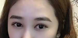 眼睛恢复很快 开心-46635
