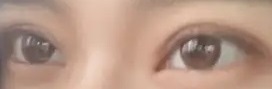 割了双眼皮之后完全是不同的感觉啊姐妹们