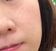 脸上的黄褐斑在逐渐变淡 真是很开心