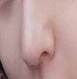 鼻子修复好了 我悬着的心终于可以放下了