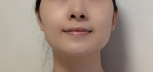 做完手术 人都自信好多倍-47633