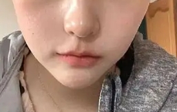 脸蛋圆嘟嘟的 可能是因为你的颊脂垫在“捣乱”