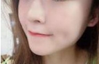 满满的元气少女感 做了这个面部填充太显小了