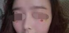 脸部就是看线条 有了美鼻整张脸看起来精致多了