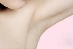 女生狐臭建议做手术吗 取决于狐臭的严重程度