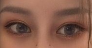 术后一个半月，现在双眼皮就自然很多了也没有很宽