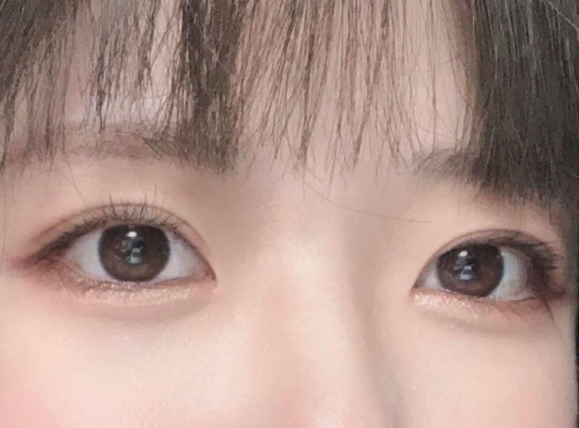 我到现在做的最正确的决定就是割了双眼皮