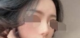 鼻部变得立体以后 五官变化特别大 