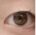 朋友们都说我的双眼皮手术非常成功