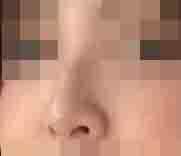 毕竟现在还在稳定期 自己平时生活也很注意