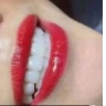 美牙结束以后牙齿立马就白了很多