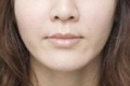 自从法令纹消除以后 原来的苦相都消失了