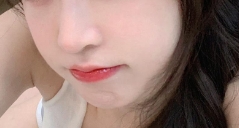 长斑真的不用怕 激光祛斑轻轻点几下就能祛斑