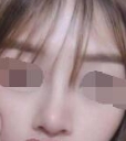 隆鼻成功以后 每天照镜子都是一种赏心悦目的享受