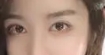 眼部变得精神不少 得到了很大的改善