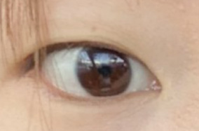 21岁单眼皮女孩的蜕变安全记录