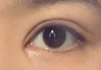 眼部基础不好 怎么做双眼皮才好看