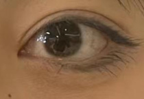双眼皮起点设计：解锁眼部风格的黄金密码