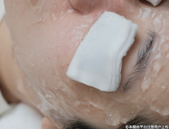 探秘光子嫩肤：安全与风险并存的美肤之旅