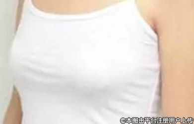 隆胸手术：科学认知与理性选择
