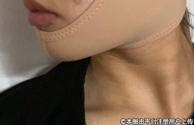 下颌角缩小整形术后护理全攻略：从饮食到康复的精细化管理