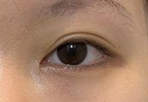 双眼皮新标准 细节控必看