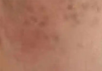 夏天不防斑，秋天烂脸警告！3招抢回素颜妈生肌​