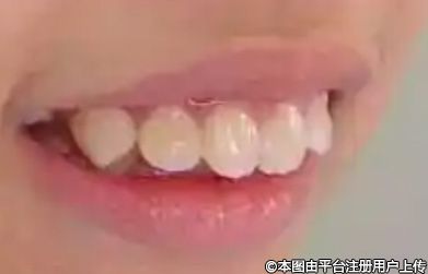 牙齿治疗：从修复到重生的科学艺术