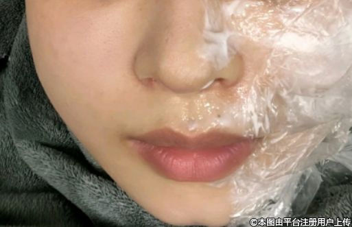 深蓝射频、热拉提、热玛吉价格对比全解析